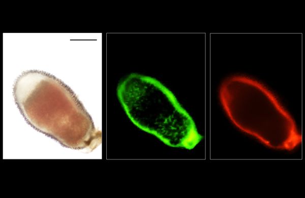 Applying cell-type-specific CRISPR in the nodules of model legume Medicago truncatula